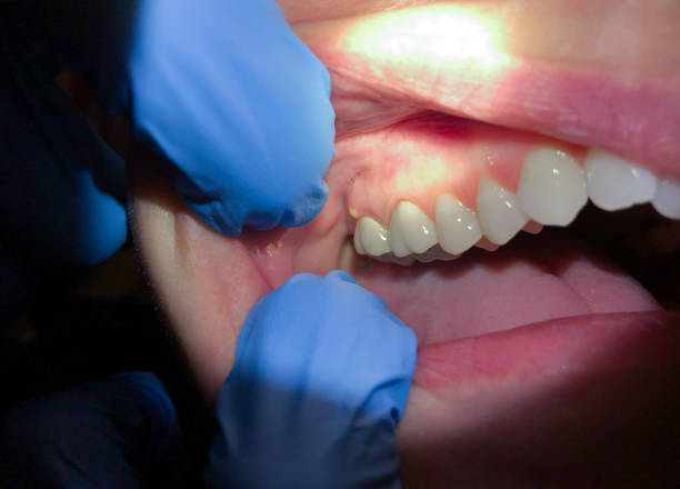Best Emergency Cosmetic Dentistry in Round Lake Beach, IL